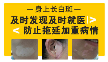 白癜风可以打新冠疫苗吗