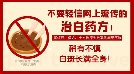石家庄治疗皮肤白斑的医院