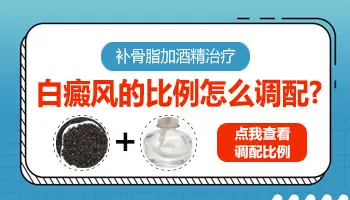 补骨脂治疗白癜风外用搭配比例