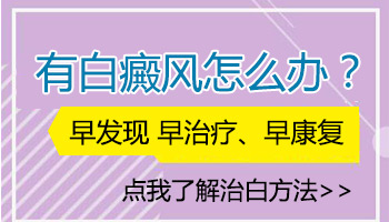 长了第一块白癜风后多久会变多