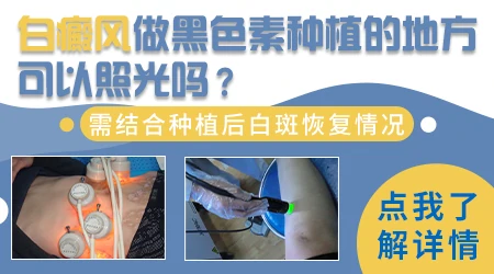 表皮移植半月后皮掉了还有白怎么办