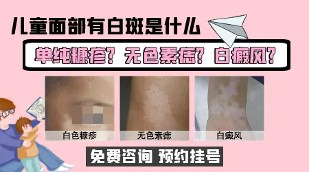 儿童脸上长淡白斑是什么原因