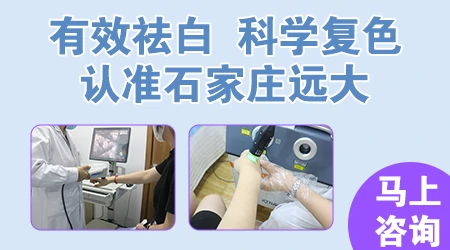 白癜风照uvb光一旦用了不能停吗