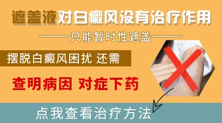 用遮盖液涂白斑会不会影响后续的治疗效果