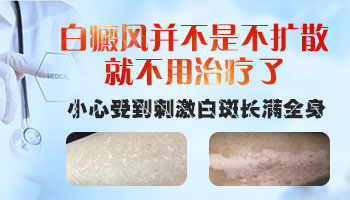 白癜风会全身变白吗