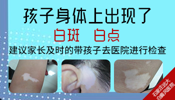 10个月大的婴儿腿部有白色的斑块