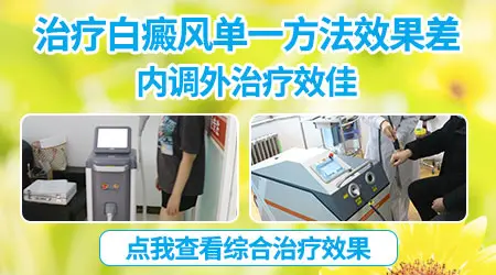 白癜风早期吃药能不能控制住 还需要光疗吗