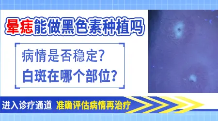晕痣型白癜风会慢慢恢复吗