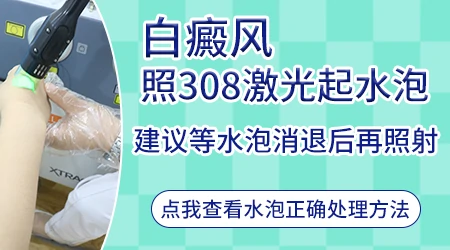 白斑做了308后起泡好还是不好