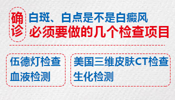 一岁孩子脸上有白斑是不是白癜风