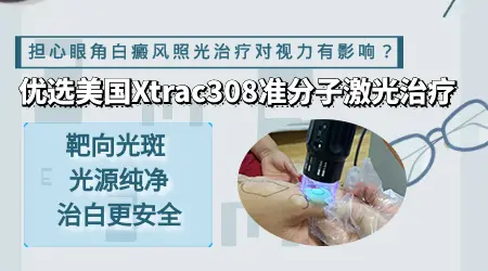 眼睛周边的白斑能照308激光吗
