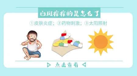 白癜风痒痒的是要扩散了吗