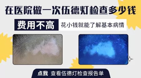 皮肤ct和伍德灯检查结果矛盾时以哪个为准