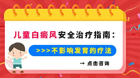 儿童脸上长白癜风选什么方法效果好