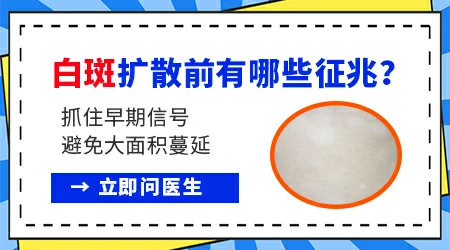 一开始白癜风有什么症状表现