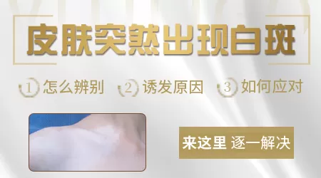 身上突然长白斑是什么原因引起的
