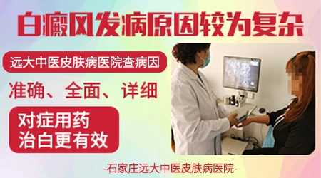 白癜风是怎么引起的