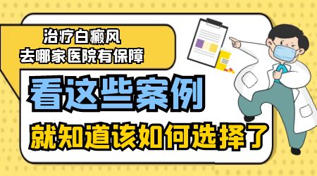 白癜风还在增多能照308激光吗