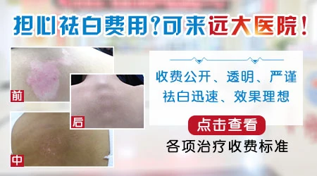 石家庄白癜风中西医结合疗效好的医院