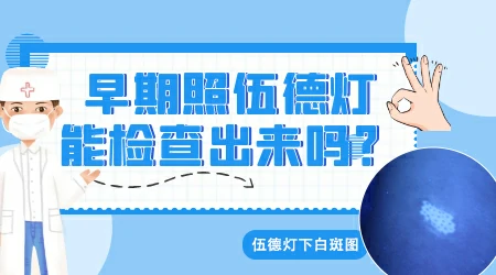 皮肤ct和伍德灯哪个比较准确