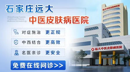 石家庄哪家医院的医生治疗白癜风有名