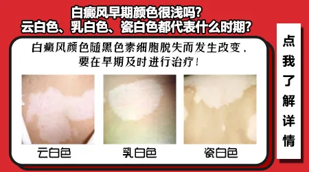 白癜风刚长出来时是纯白色吗？早期颜色变化全过程