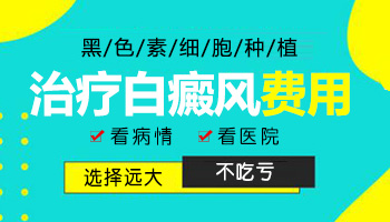 白癜风细胞移植多少钱