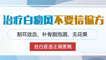 偏方治疗白癜风的方法哪个好一些