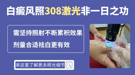 用308治疗白癜风一周照几次
