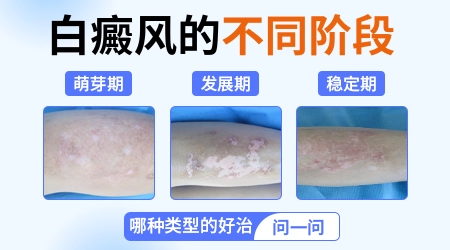 皮肤出现一小块白色的东西是什么原因