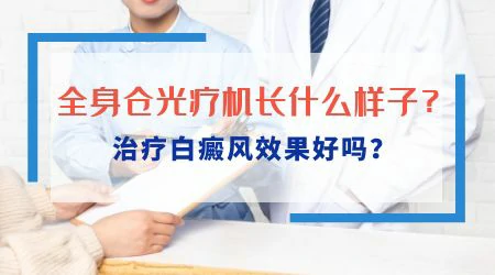 全身仓治疗白癜风管事吗