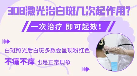 白癜风照308激光间隔多久做一次合适