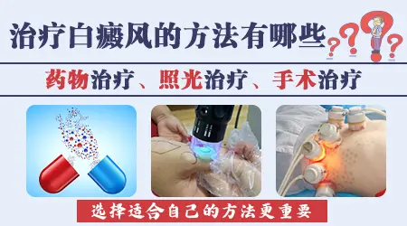 目前治疗白癜风好的方法是什么