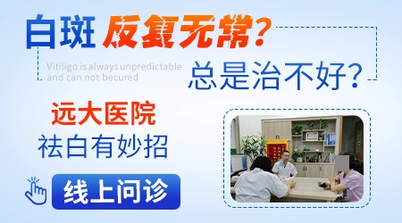 不同类型的白癜风治疗方法一样吗
