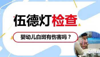 一岁多宝宝可以做伍德灯检查白斑吗