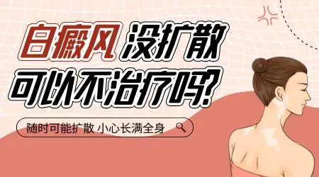 白癜风不治疗会怎么样会自愈吗