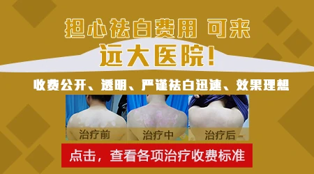 石家庄远大中医皮肤病医院治白癜风怎么样