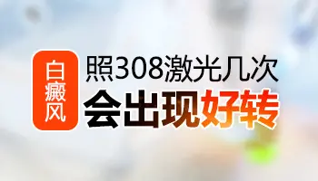 308激光治疗白癜风照射几次能见效