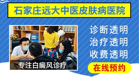 伍德灯能区分白癜风初期白斑和汗斑吗