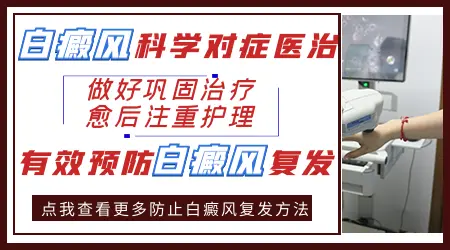 家用308光疗仪照白癜风好后会不会复发