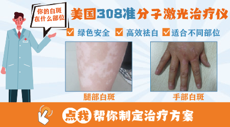 白癜风夏天越晒越多怎么回事