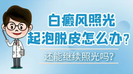 白癜风红痒起水泡还能继续光疗吗
