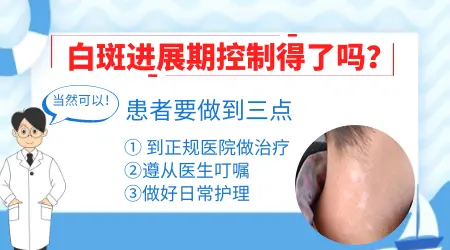 如何判断白癜风是否处于进展期