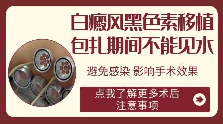 白斑表皮移植表皮多久脱落完