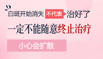 初期白癜风照308激光多少次后可以停止