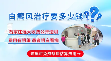 石家庄308激光治疗一次白癜风多少钱