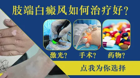 大腿内侧白癜风图片