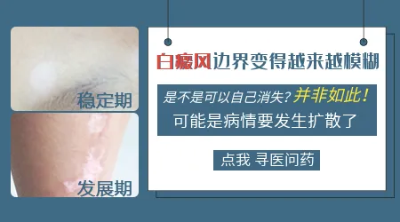 白斑边界模糊时可以照光吗