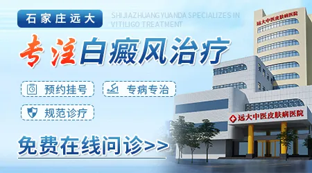 石家庄治疗皮肤白斑好的医院