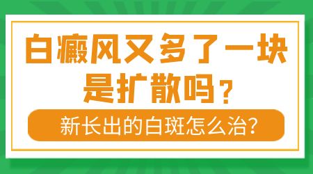 腰部白癜风会扩散到脸上吗 如何治疗腰部白癜风